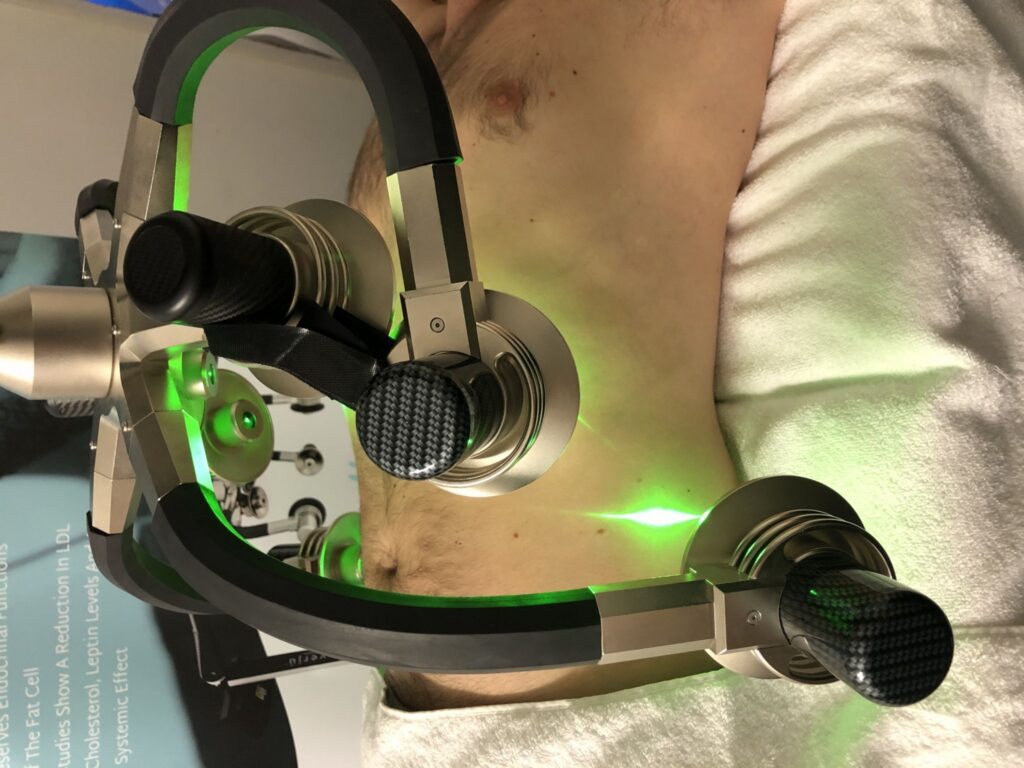 Laser Verju podczas zabiegu na ciele